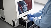 Scope Fluidics Implements Mass Production Of Pcr|One System Which Detects Bacterial And Viral Infections In 15 Minutes