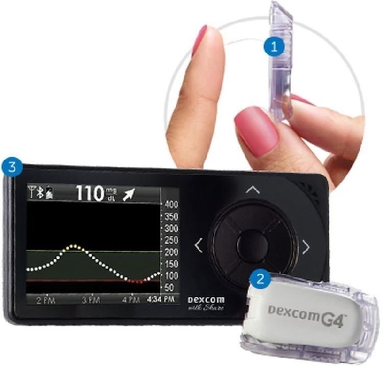 Continuous Glucose Monitoring Device DEXCOM G4 PLATINUM Now Available 